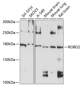 ROBO2 Antibody