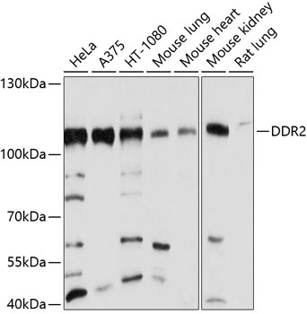 DDR2 Antibody