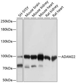 ADAM22 Antibody