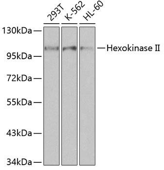 Hexokinase II Antibody