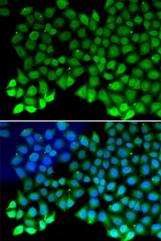 RPA1 Antibody