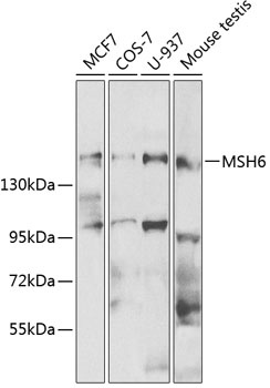 MSH6 Antibody