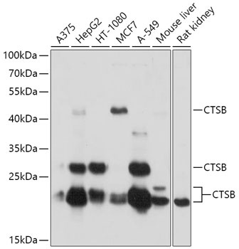 CTSB Antibody