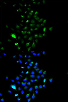 JUP Antibody