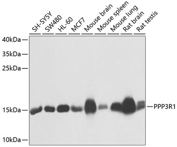 PPP3R1 Antibody