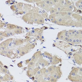 FABP5 Antibody