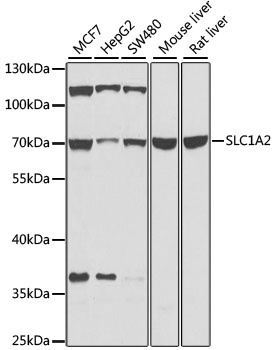 SLC1A2 Antibody