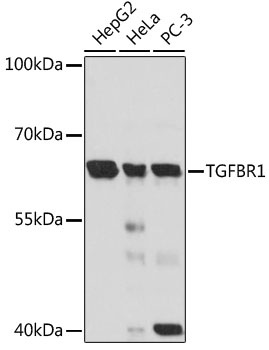 TGFBR1 Antibody