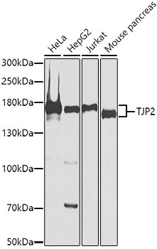 TJP2 Antibody