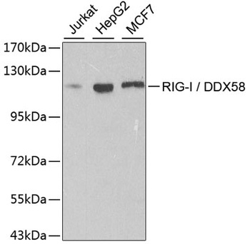 RIG-I / DDX58 Antibody