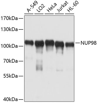 NUP98 Antibody
