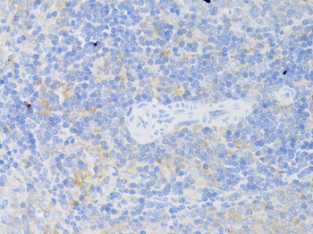 CD4 Antibody