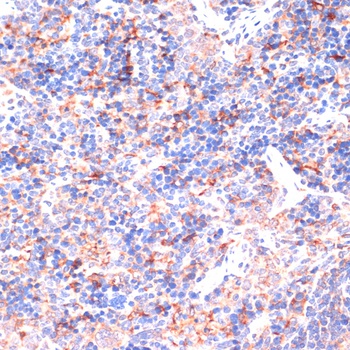 IL6 Antibody