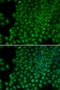 POLR1C Antibody