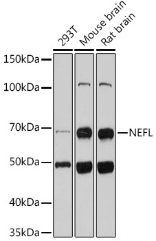 NEFL Antibody