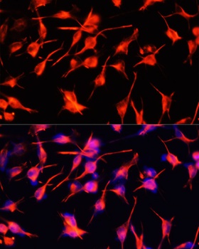 GFAP Antibody