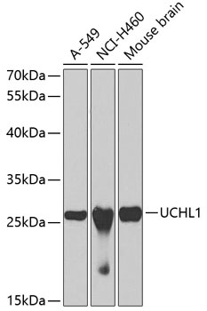 UCHL1 Antibody