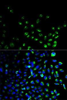 UCHL1 Antibody