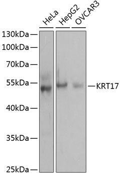 KRT17 Antibody