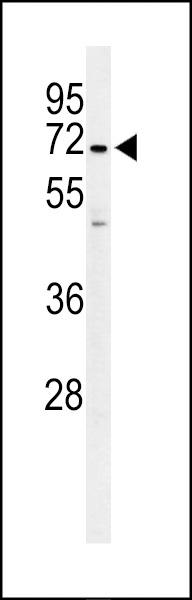 PPP1R18 Antibody