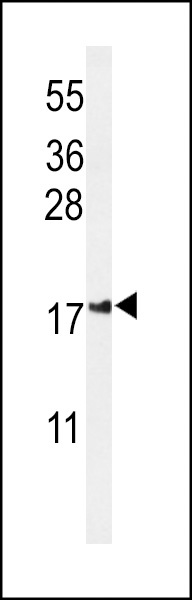 IMMP2L Antibody