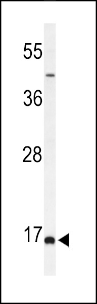 FAM44B Antibody