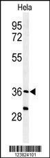 SUMF1 Antibody