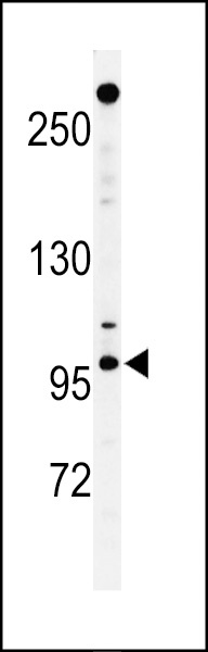 NUP210 Antibody