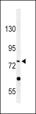 PLA2G6 Antibody