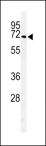 ARSI Antibody