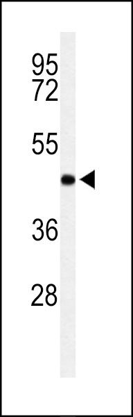 RPRD1B Antibody