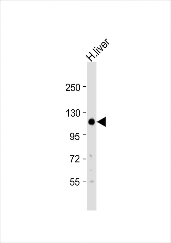 DENND1A Antibody