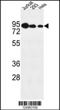 NOL9 Antibody