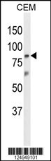 ZNF160 Antibody