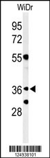 NSMCE4A Antibody