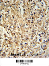 DDX6 Antibody