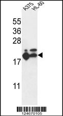 RPL17 Antibody