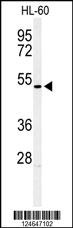 HOXA3 Antibody