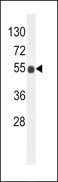 B3GNT6 Antibody