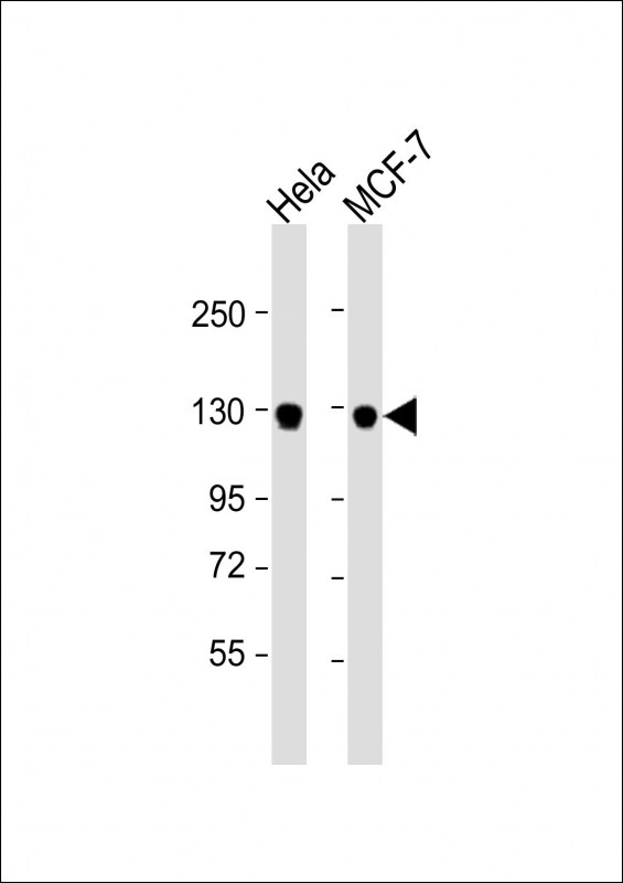 GTSE1 Antibody