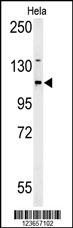 ADCY4 Antibody
