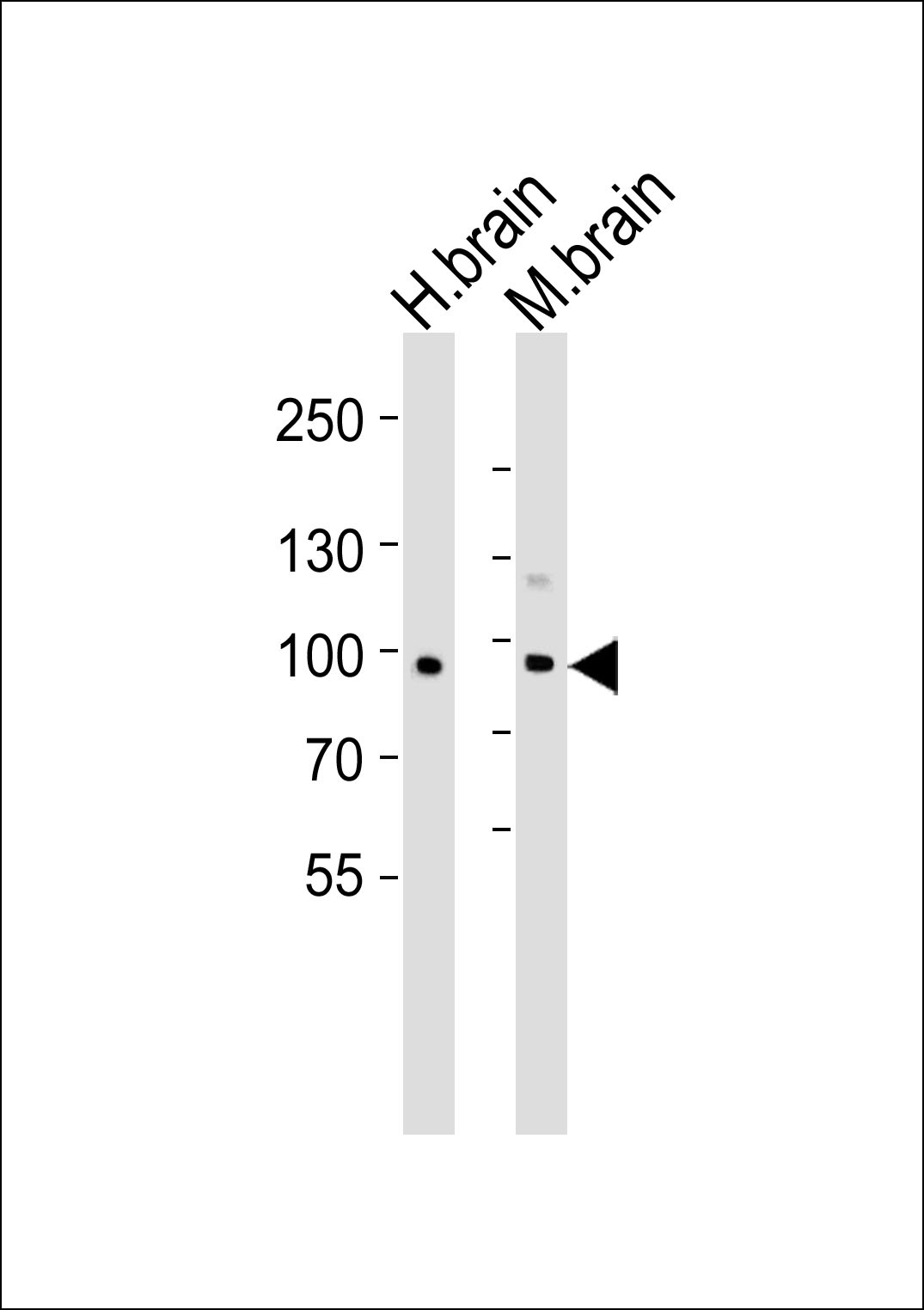 CDH20 Antibody