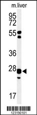 GSTK1 Antibody