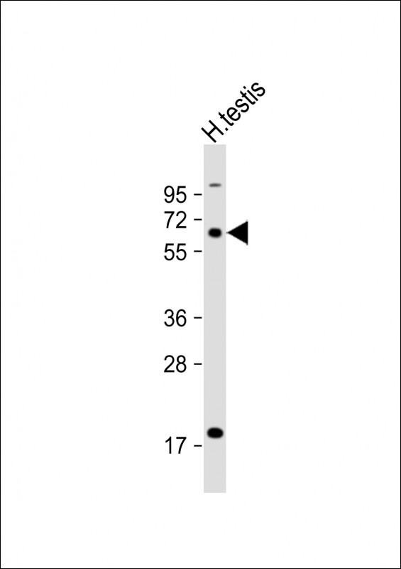 ACSBG2 Antibody