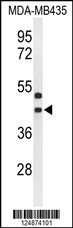 GPR17 Antibody