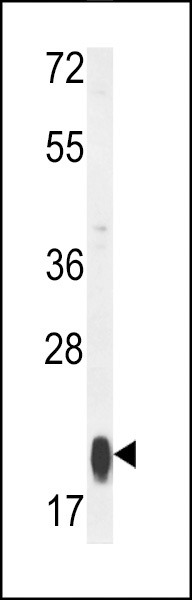 MRPS25 Antibody