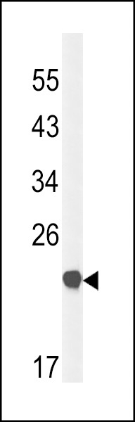 CLDN23 Antibody