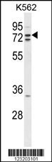 ZRANB1 Antibody