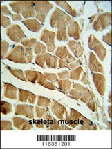 CAPN3 Antibody