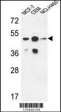 SGMS2 Antibody